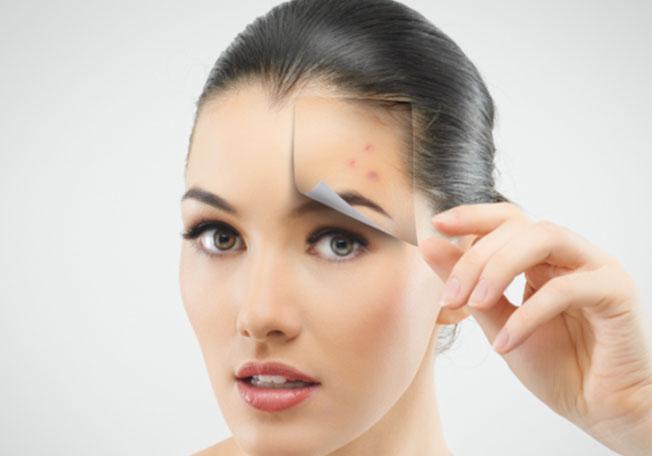 how to get rid of deep chicken pox scars on face